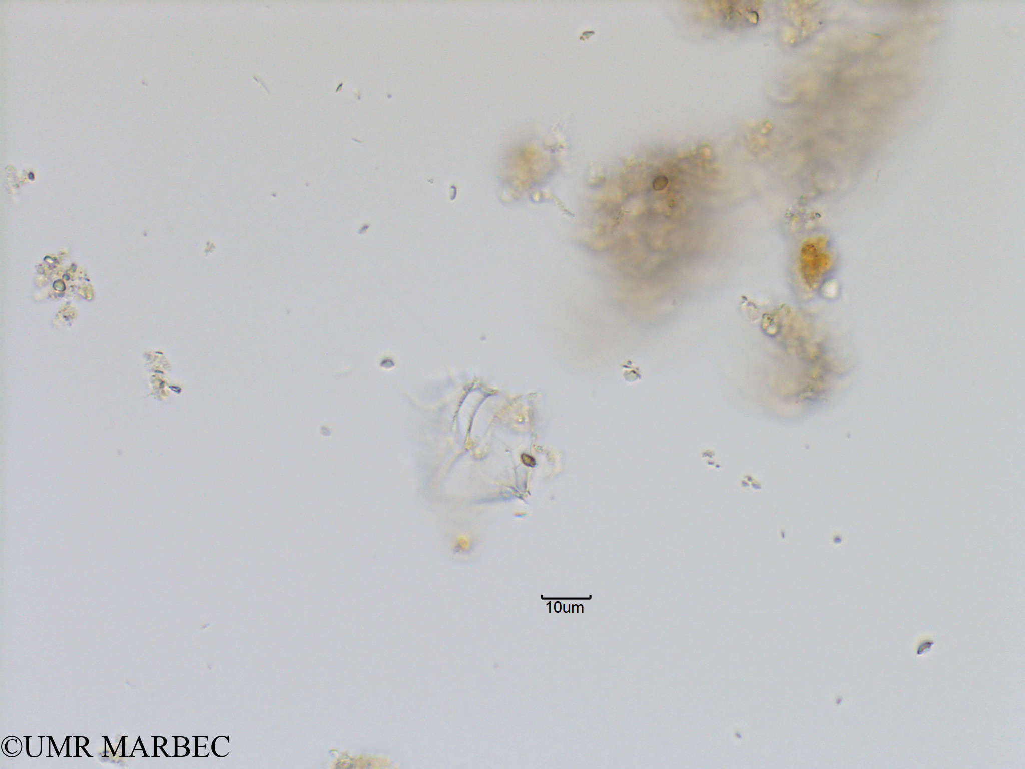 phyto/Bizerte/bizerte_lagoon/RISCO November 2015/Protoperidinium quinquecorne (Lagune_T1_C_Gonyaulax gde epine-0).tif(copy).jpg
